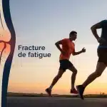 qu est-ce qu une fracture de fatigue os fissuré